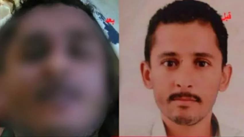 وفاة مختطف في سجون مليشيا الحوثي بعد 7 سنوات من اختطافه