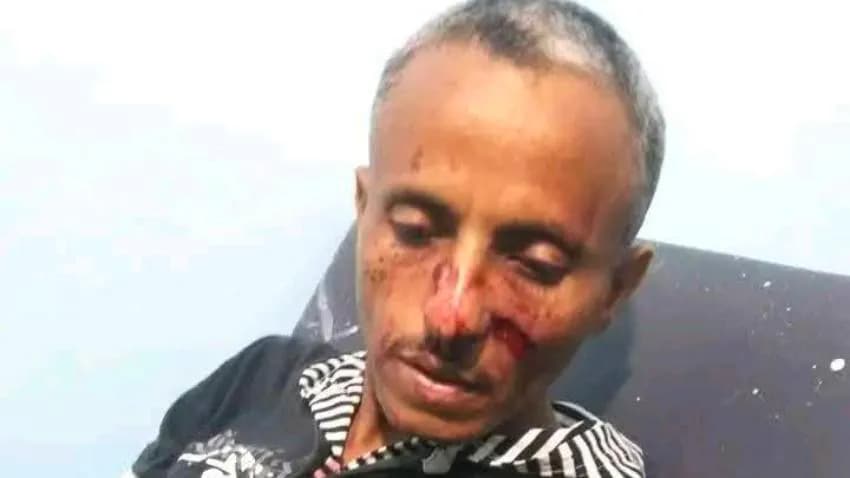 تعز.. قتيل وجرحى بإطلاق نار في سوق شعبية بمديرية شرعب الرونة