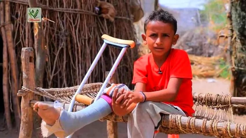 منظمة دولية: ارتفاع حصيلة ضحايا الألغام من الأطفال باليمن إلى 40 منذ بداية 2025