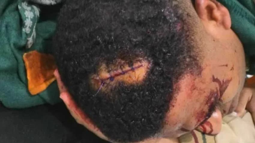 نقابة الصحفيين تدعو إلى فتح تحقيقٍ في حادثة الاعتداء على صحفي في تعز