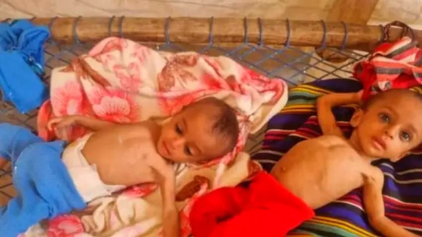 حجة.. أكثر من 41 ألف شخص يواجهون شبح المجاعة في مديرية عبس
