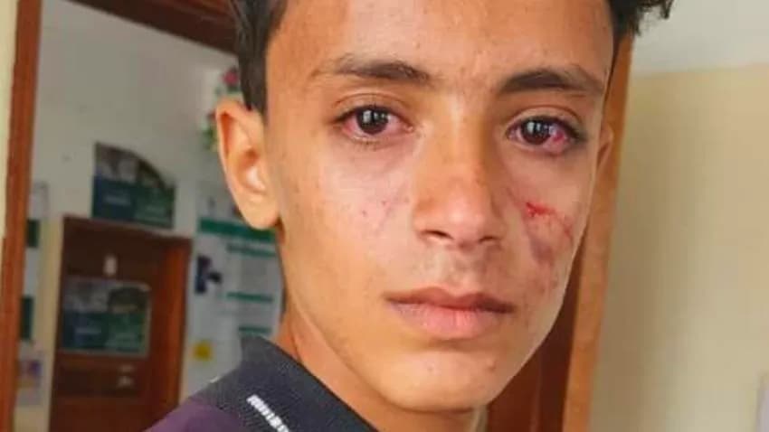 مشرف حوثي يعتدي على طفل ووالدته في ريمة وسط غضب شعبي واسع