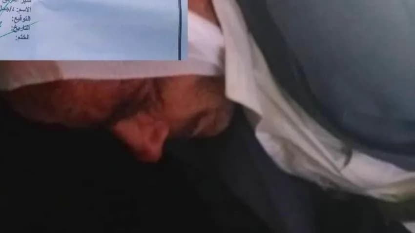 تعرض مواطن يعاني من اضطرابات نفسية لاعتداء وحشي في إب