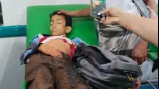 تعز: قناص حوثي يقتل طفلاً أثناء عودته من مدرسته