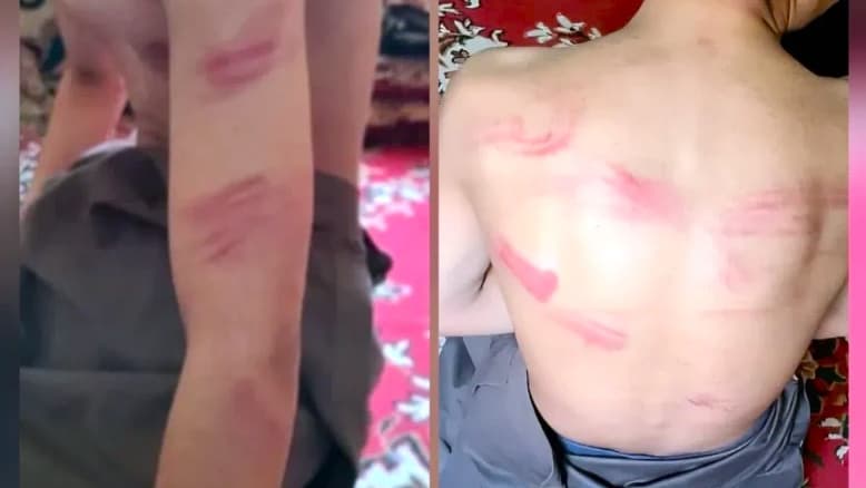 صعدة: حوثيون يعذبون طفلاً بشكل وحشي في ضحيان