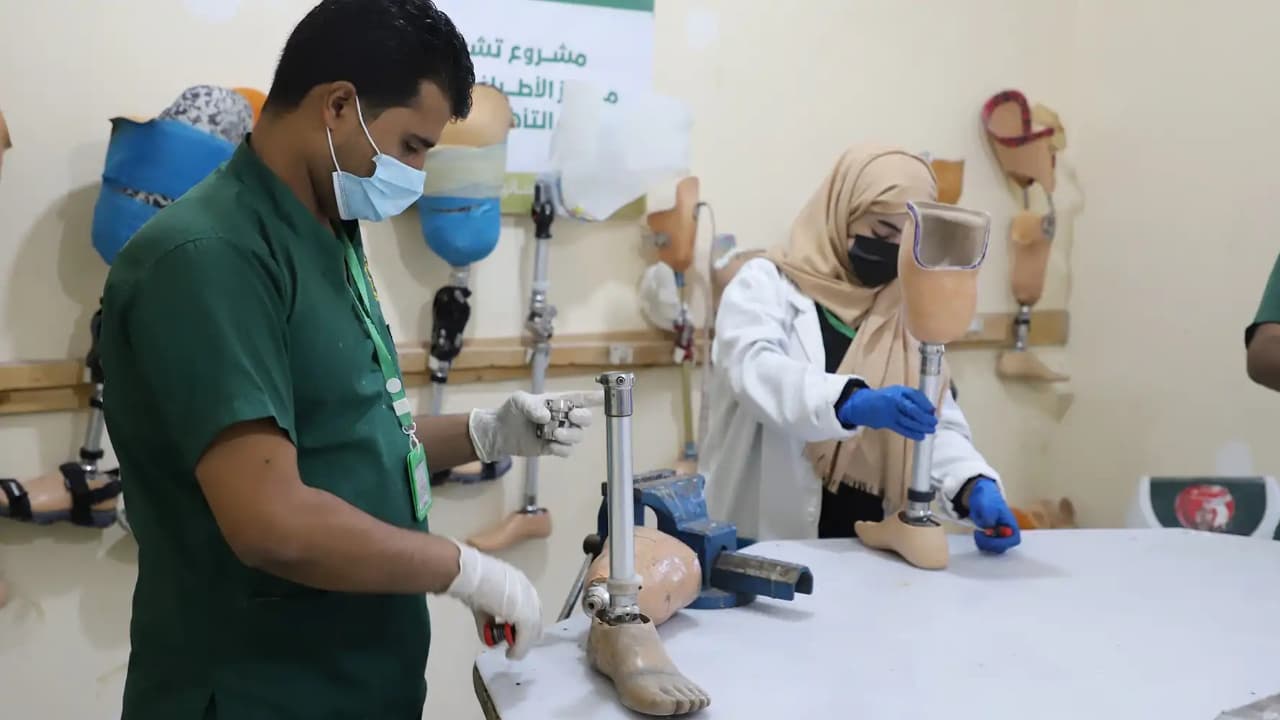 تعز: مركز الأطراف الصناعية يقدم خدماته لأكثر من 3500 مستفيد بين يناير ومايو من العام الجاري