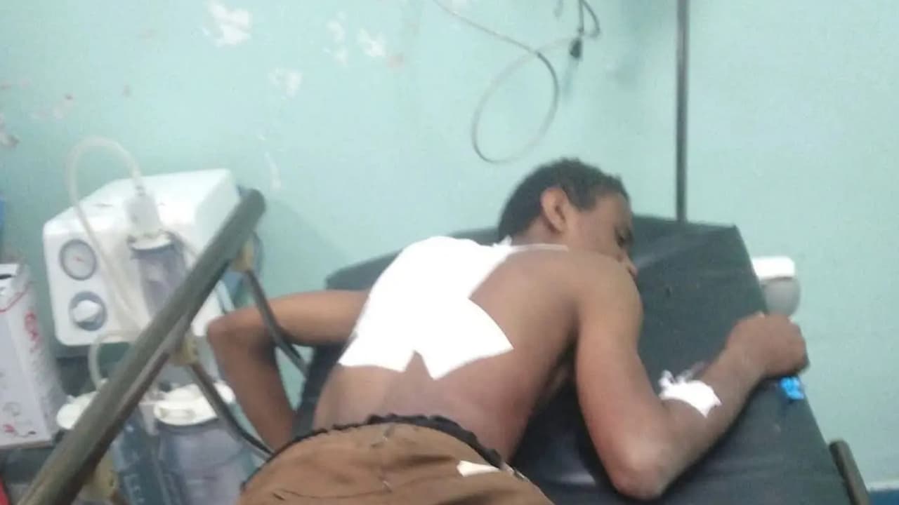 إصابة مواطن بجروح خطيرة في قصف حوثي استهدف منازل ومزارع شمالي الضالع