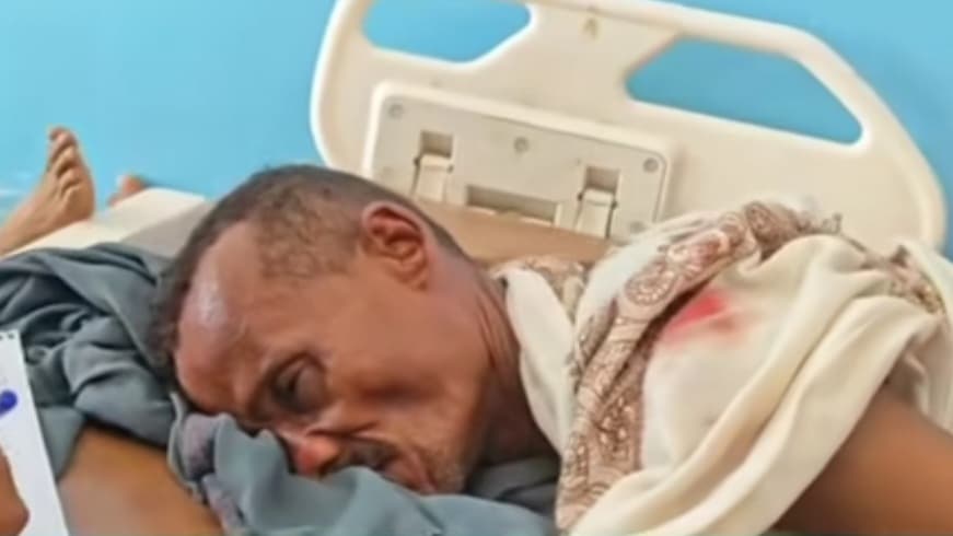 مقتل امرأة وإصابة زوجها وابنتها بقصف لميليشيا الحوثي على قرية القلمة بمديرية حيس