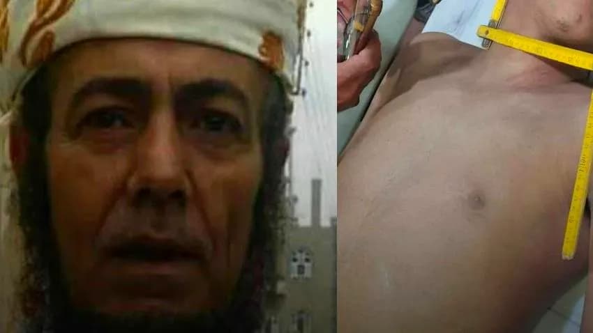 وفاة فتى في إب على يد قارئ رقية شرعية بعد تعرضه للضرب والخنق بزعم العلاج من السحر