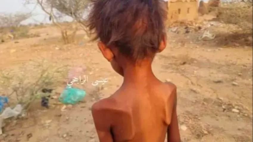 تقرير أممي: أكثر من 41 ألف شخص في عبس يواجهون خطر المجاعة وتفاقم الأوضاع الإنسانية