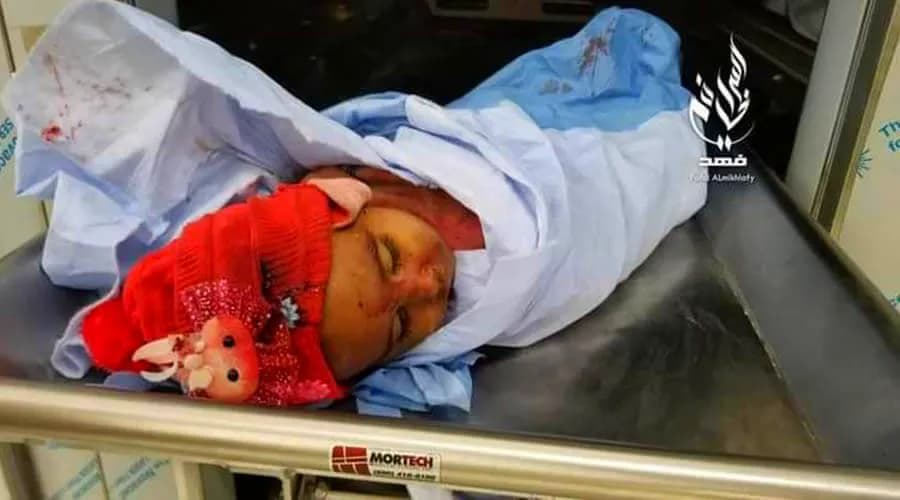 جرائم الحوثيين.. شهيدان في تعز وارتفاع الضحايا بالحديدة إلى 18