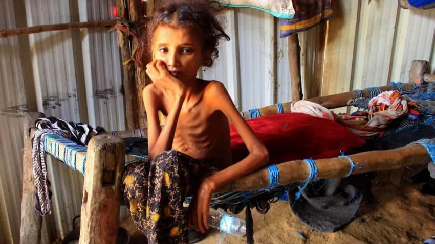 تقرير أممي: 16 مليون يمني يعاني الجوع