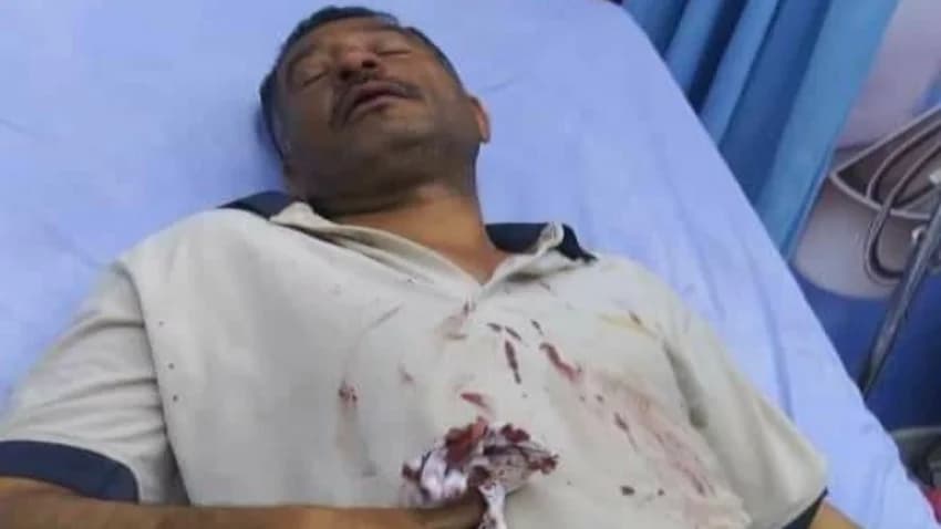 الصحفي العزيزي يتعرض لاعتداء "بليغ" مدفوع من مالك منزله