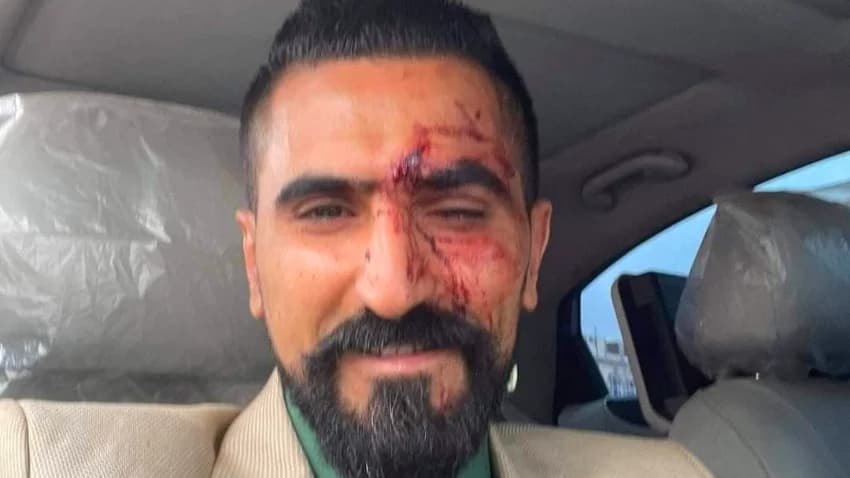 محامي "الشاب الأغبري" يتعرّض لاعتداء وسط محكمة في صنعاء
