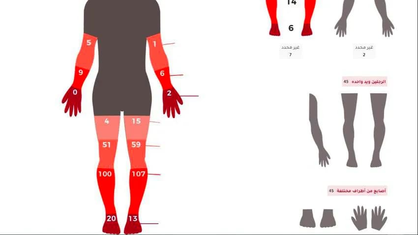 تحقيق استقصائي يكشف قيام مستشفيات في تعز بعمليات بتر أعضاء دون الحاجة لذلك