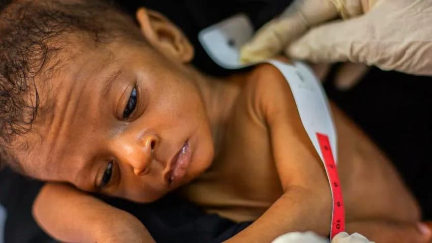 لا معنى للطفولة في اليمن.. لقد أنساهم الجوع حتى مجرد التفكير باللعب