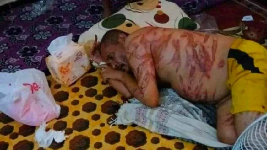 دعوات إلى التحقيق في وفاة مواطن بعد تعذيبه في سجون الانتقالي بأبين