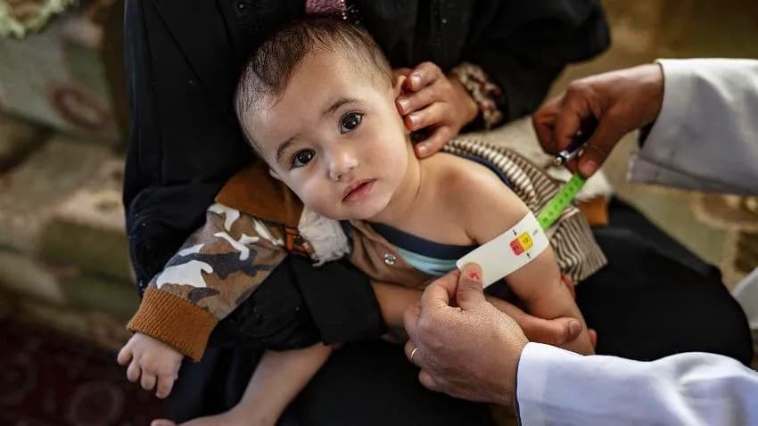 الأمم المتحدة: منظمات إغاثية تقلص مساعداتها في اليمن بسبب نقص التمويل