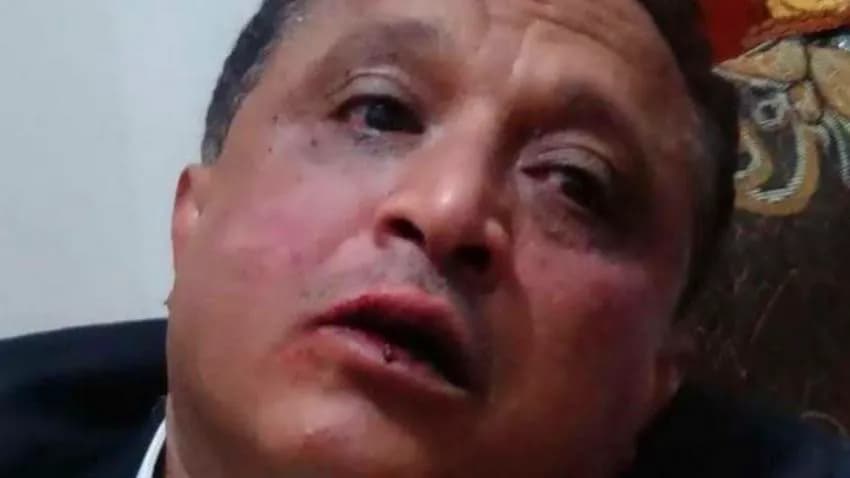 نقابة الصحفيين تدين الاعتداء على الزميل مجلي الصمدي