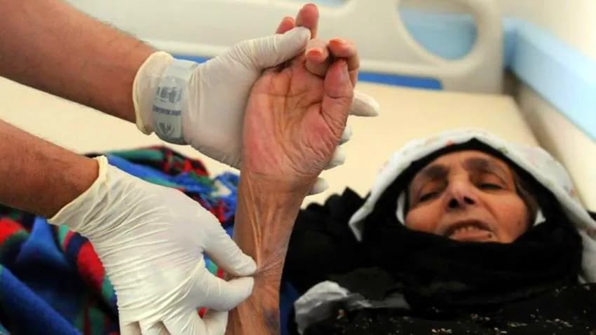 تسجيل 262 حالة اشتباه بالكوليرا خلال شهرين في حضرموت
