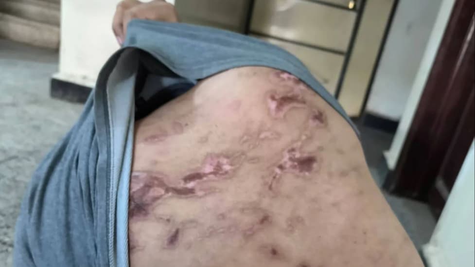 حضرموت.. معتقل سابق يكشف ممارسات تعذيب داخل سجون سرية