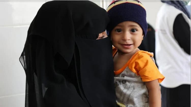 خلال 4 أشهر.. تسجيل 599 إصابة بسوء التغذية الحاد الوخيم بين الأطفال في عمران