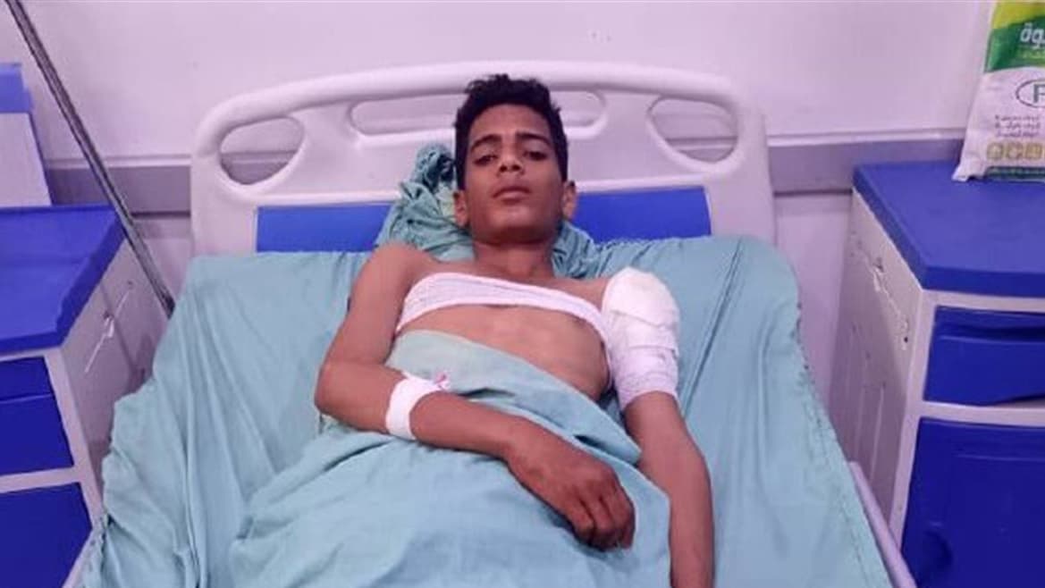 لحج: إصابة شاب جراء استهداف مليشيا الحوثي المدنيين في المسيمير