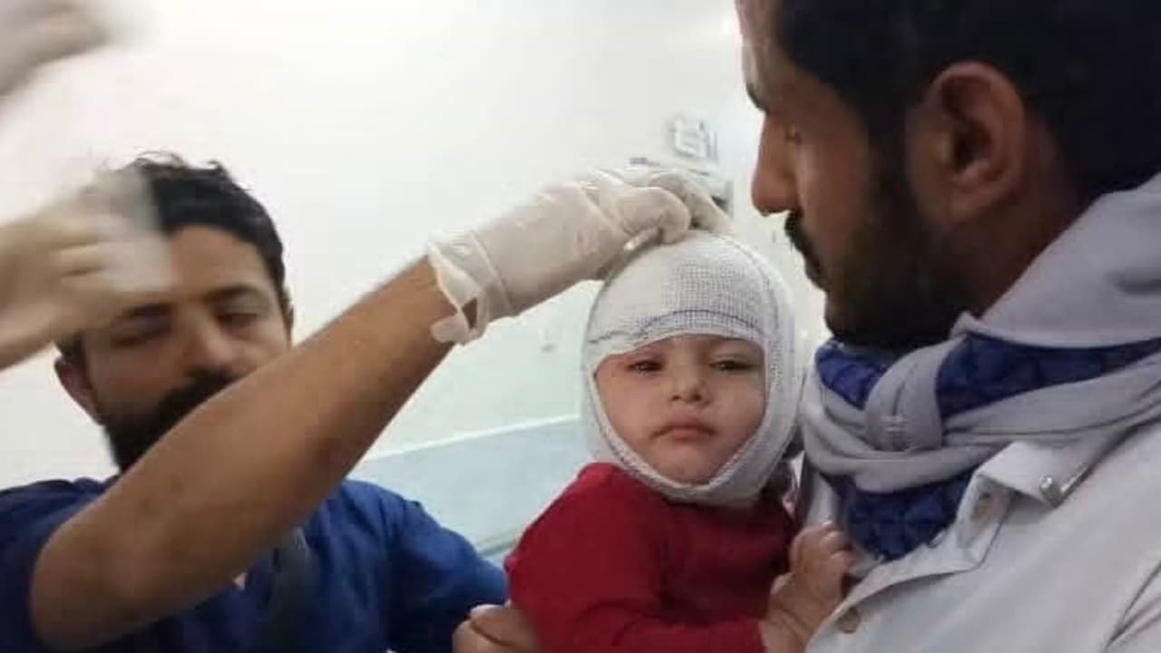 قصف حوثي يستهدف النازحين بمأرب.. قتيلان و14 جريحاً في تصعيد حوثي جديد