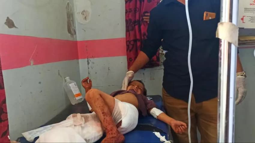 استشهاد 3 أطفال وإصابة 3 آخرين بقصف حوثي على تعز