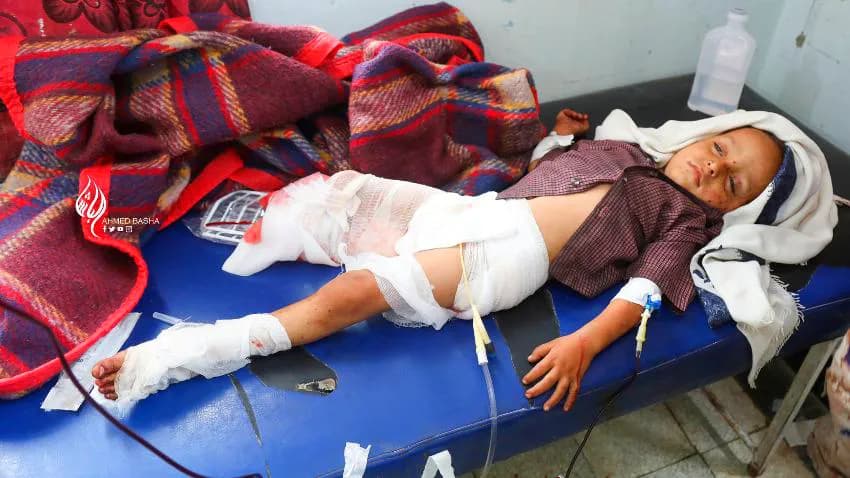 دون الإشارة إلى الحوثيين.. الأمم المتحدة تعلن مقتل 15 مدنيا في اليمن