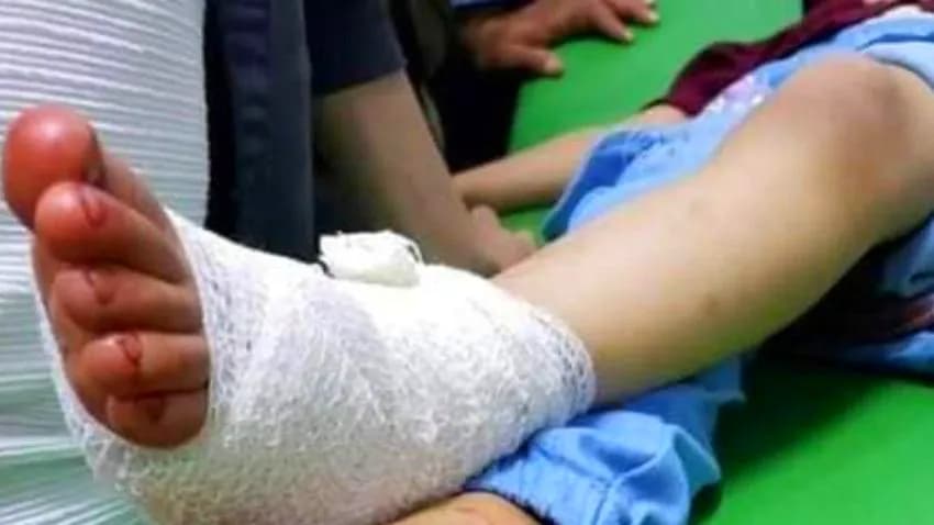 إدانات واسعة لجرائم مليشيا الحوثي بحق المدنيين في تعز رغم الهدنة