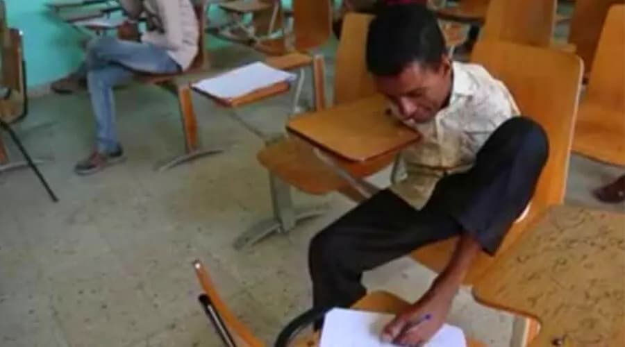محمد.. قصة شاب مبتور اليدين تحدى الإعاقة في تعز