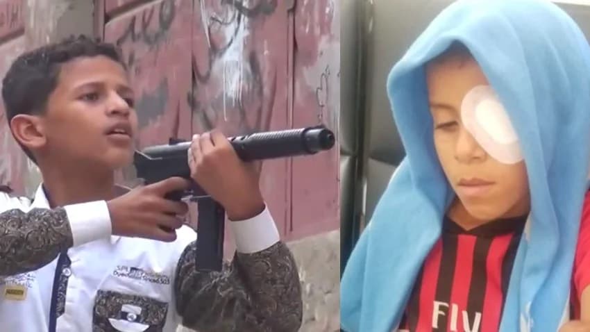 أسلحة الخرز.. مرح يدمى أعين الأطفال ويثقل كاهل آبائهم في تعز