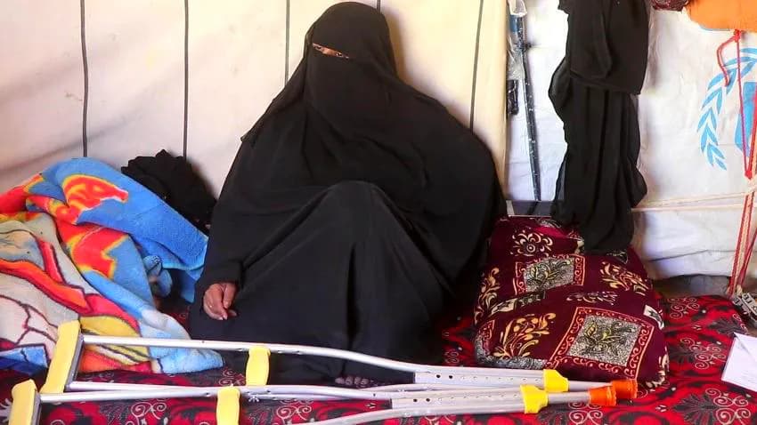 موقع "بلقيس" في منزل راوية.. داست لغما زرعه الحوثيون في عتبة بيتها وفقدت ساقها