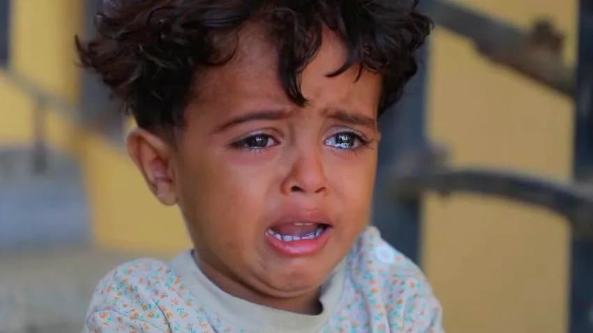 قصة مبكية لطفل يمني بُترت قدمه اثر انفجار لغم أرضي زرعته مليشيا الحوثي