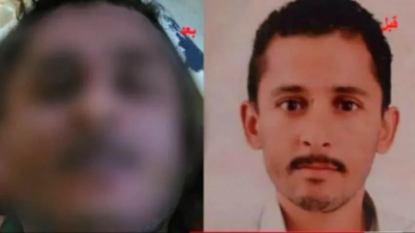 التعذيب حتى الموت.. أوضاع المختطفين في سجون مليشيا الحوثي